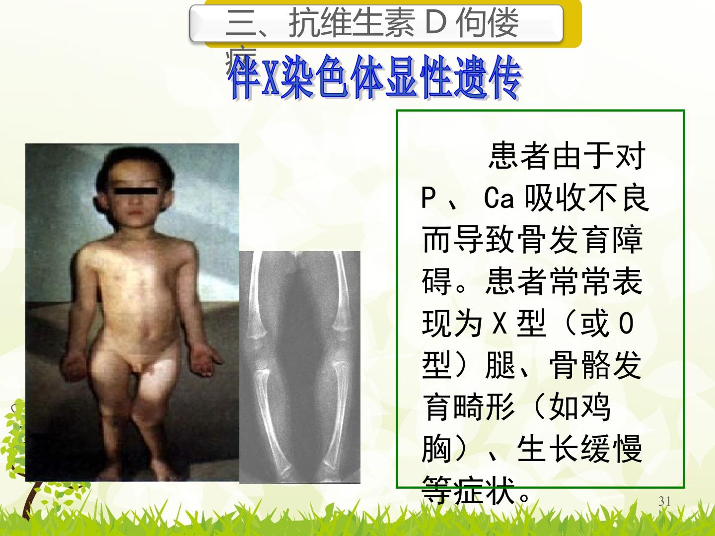 31.jpg