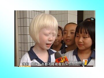 基因指导蛋白质的合成