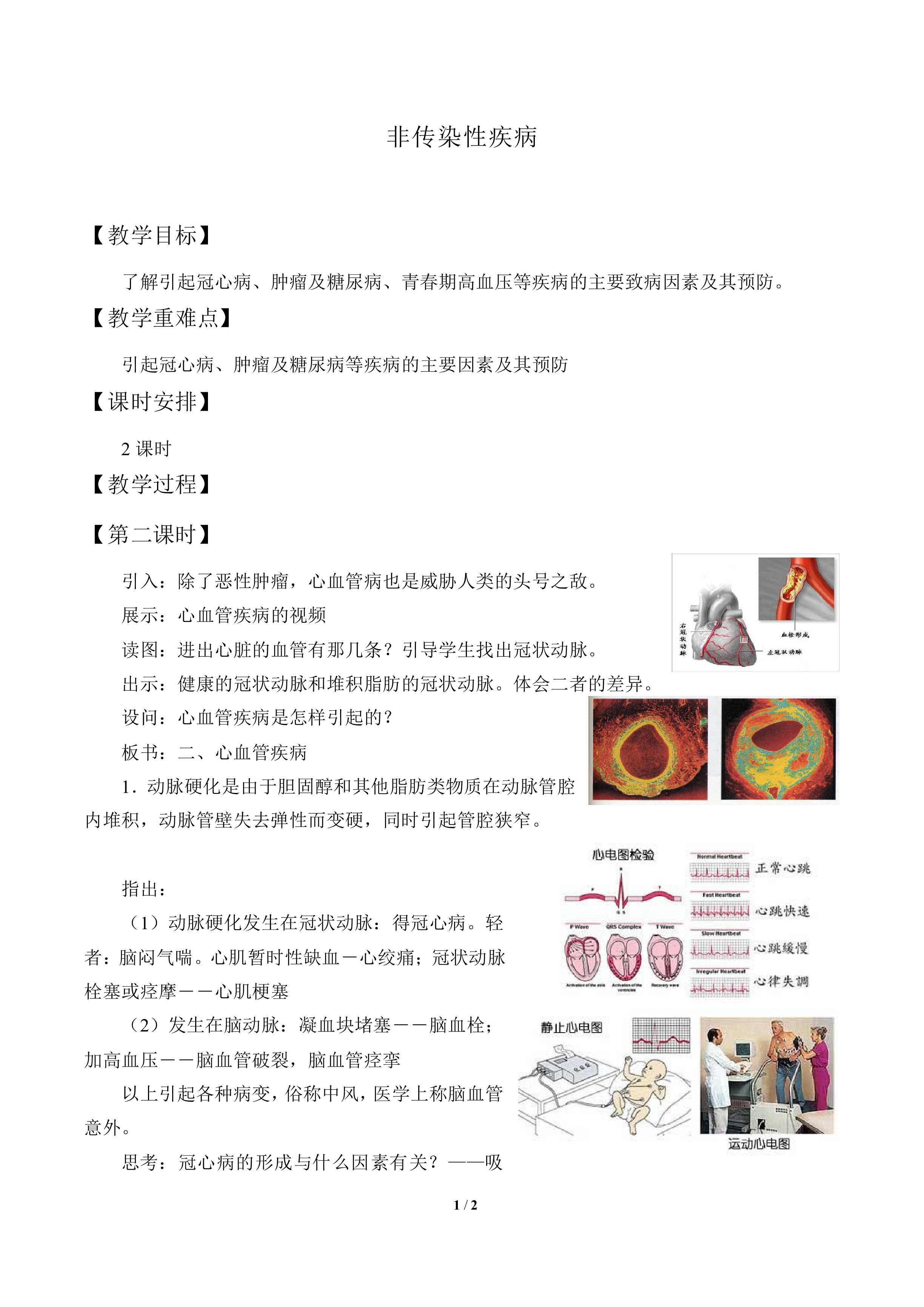 非传染性疾病_教案1